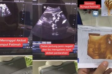Rumput Fatimah Merenggut Nyawa Bayi tak Berdosa, Si Ibu Kritis Hingga Habiskan 20 Kantung Darah