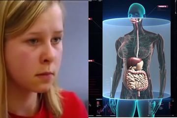 Mata Gadis Ini Bisa Melihat Tembus Pandang Seperti Alat Medis X-ray