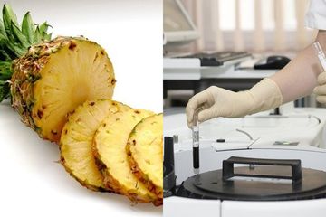 Sering Dianggap Momok Menakutkan Bagi Ibu Hamil Buah Nanas Ternyata Manjur Obati Penyakit Ganas Ini Semua Halaman Sajian Sedap