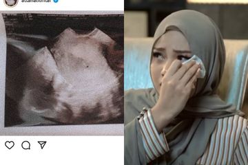 Pelajaran Berharga dari Aurel Hermansyah Mengenai Keguguran, Istri Atta Halilintar Ceritakan Sejak Awal Kejadian