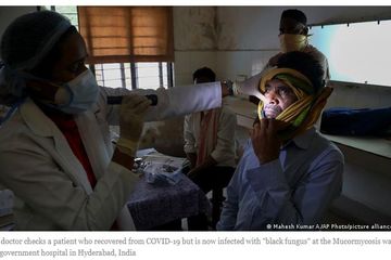 6 Negara Ini Sudah Terpapar Infeksi Jamur Hitam Mucormycosis, Waspada!