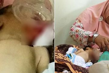 Bayi Diberi Pisang, Usia 10 Hari Meninggal, Ibu Bayi 4 Bulan Dimarahi Warganet