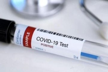 Jangan keburu panik lihat hasil tes PCR, CT Value tak cukup jadi patokan.