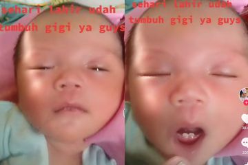 Viral Bayi Berusia 1 Hari Sudah Tumbuh Gigi Pahami Kondisi Natal Teeth Yang Bikin Bayi Baru Lahir Langsung Punya Gigi Normal Atau Berbahaya Semua Halaman Nakita