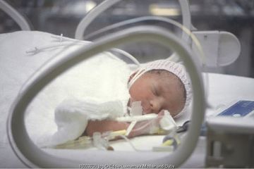 Bayi di rawat di NICU