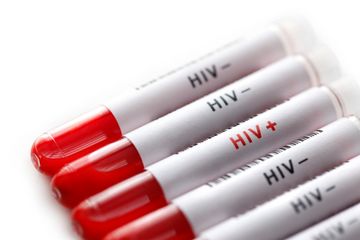 Pengobatan HIV/AIDS memerlukan pengobatan yang teliti dan seksama.