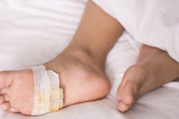 Sedapat mungkin cegah luka diabetes agar tidak menimbulkan komplikasi.