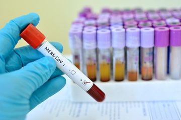 Masa inkubasi MERS- CoV yang panjang adalah kabar baik  meski juga disebabkan oleh virus corona.