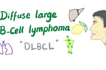 Penjelasan sederhana DLBCL, penyakit yang diderita Ari lasso. 