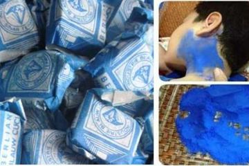Mengobati gondongan dengan blau cuci baju. Ternyata ini tujuannya. 