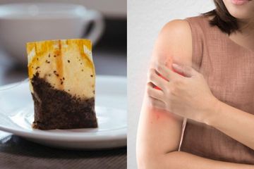 Mengatasi gatal akibat gigitan nyamuk dengan teh