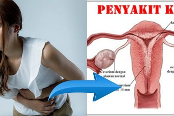 Perempuan yang memiliki kista bisa hamil kok.