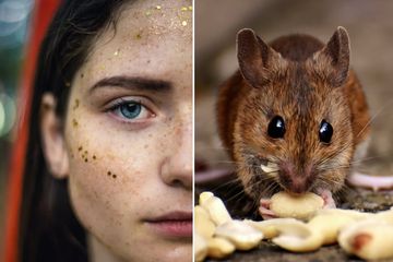 BERITA POPULER menghilangkan flek hitam hingga membasmi tikus