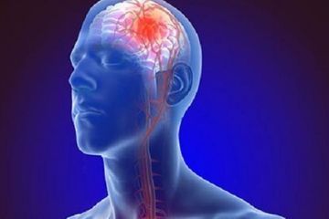 5 Tips Meningkatkan Neuroplastisitas dan Pemulihan Pasca Stroke