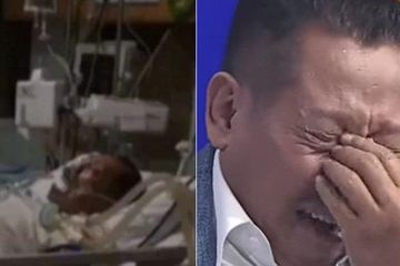 Seperti ini proses pemulihan yang akan dialami oleh Tukul Arwana pasca operasi otak.