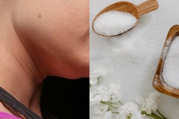 Cara membuat leher hitam kembali putih dengan garam.
