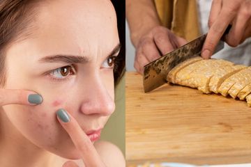 Cara membuat wajah glowing dan bebas jerawat dengan tempe