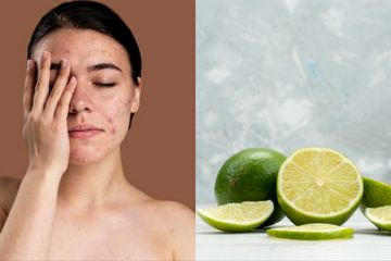 Cara menghilangkan noda minyak dan jerawat dengan jeruk nipis