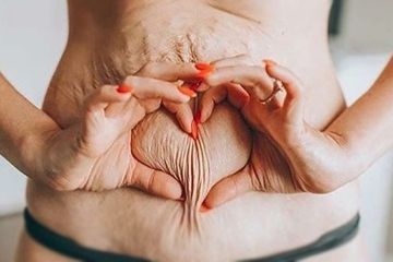 5 Perubahan Tubuh yang Harus Perempuan Terima Setelah Melahirkan, Jangan Baper
