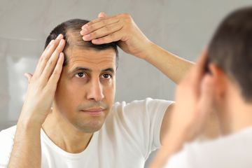 Bulu dan Rambut Rontok, Inilah Penyebab Penyandang Diabetes Alami Kebotakan