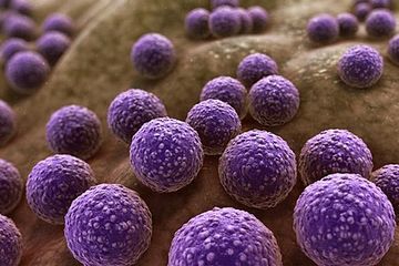 MRSA, Infeksi Akibat Bakteri yang Semakin Resisten Terhadap Antibiotik