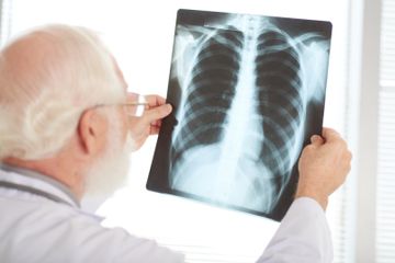 Bronkitis akut dapat menular kepada orang lain, melalui virus yang melayang di udara ketika batuk atau bersin.