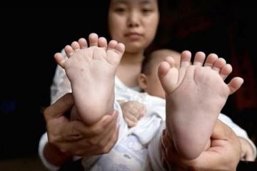 Anak hasil inses, ibu dan bapaknya masih saudara sedarah.