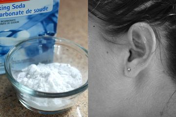Cara membersihkan kotoran telinga dengan baking soda