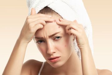 Selain dengan salep, inilah rekomendasi obat jerawat minum