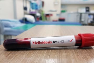 Melioidosis, penyakit yang disebabkan oleh bakteri yang bisa berujung kematian.