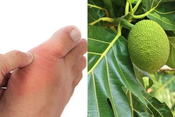 Resep obat asam urat dari daun sukun. Bia dibuat sendiri di rumah.
