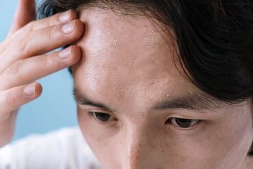 Infeksi Sinusitis Bisa Sebabkan Dahi Sakit, Begini Cara Mengobatinya