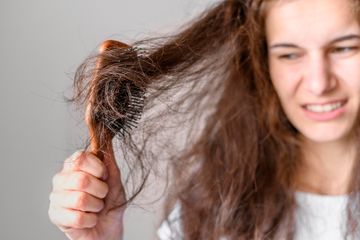Jangan Sepelekan, Rambut Rontok Jadi Ciri-ciri Awal Idap Penyakit ini