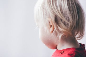 Penyebab rambut rontok pada anak