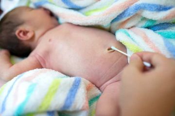 Penyakit infeksi bisa menyerang tali pusar bayi.