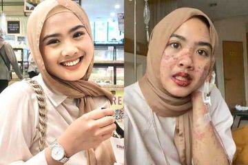 Afina Syifa sempat ingin bunuh diri karena kondisinya.