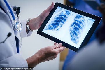 Untuk skrining TBC besar-besarn di 2022 ini, pemerintah akan menggunakan X-Ray Artificial Intelligence.