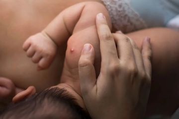 Bagian Tubuh Bayi yang Rawan Bisul, Ini 5 Cara Mengobatinya 