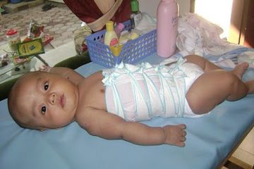 Jangankan Pada Bayi Menggunakan Gurita Pada Ibu Usai Melahirkan Tidak Dianjurkan