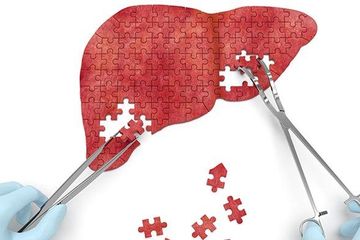 Hepatitis akut yang belum diketahui penyebabnya ini secara resmi telah dipublikasikan sebagai kejadian luar biasa (KLB) oleh Organisasi Kesehatan Dunia WHO.