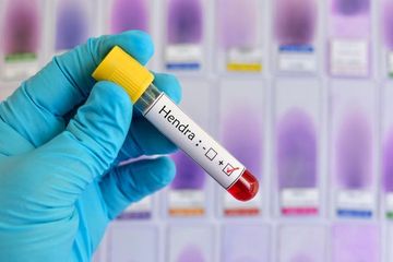 Infeksi virus bisa menginfeksi kuda dan manusia, dan Hendra berakibat fatal pada manusia.