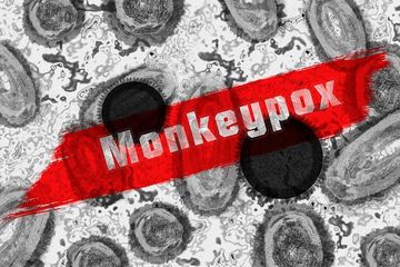 =Cacar monyet atau monkeypox beriko menjadi pandemi selanjutnya.
