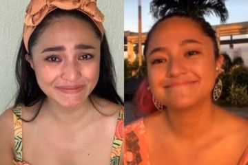 Setelah menderita bipolar Marshanda idap tumor payudara. 