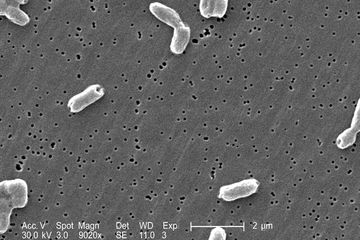 Berita Penyakit Tifus Terbaru Hari Ini - Kids