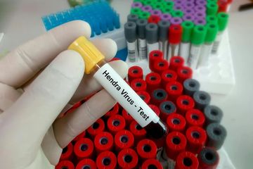 Virus Hendra memiliki tingkat kematian yang tinggi.