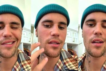 Wajah Justin Bieber lumpuh karena sindrom Ramsay Hunt.