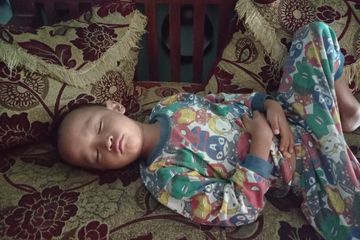 Perut anak buncit tapi kurus.