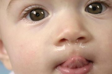 Anak ingusan tak kunjung sembuh dan tanpa disertai demam ada 4 penyebabnya.