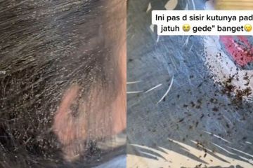 Cara Ampuh Basmi Kutu Rambut dengan Uap Ekstrak Daun Jeruk Nipis dan Minyak Kayu Putih