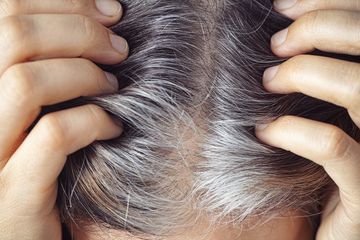 Perempuan Perokok dan Sering Stres Paling Cepat Tumbuh Uban? Ini Faktanya